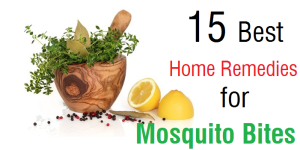 15 Best Home Remedies for Mosquito Bites